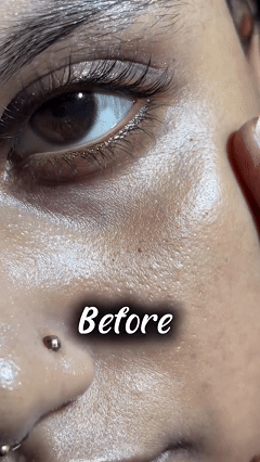 Anti Ageing & Dark Circles Serum 50ML (Pack of 1)