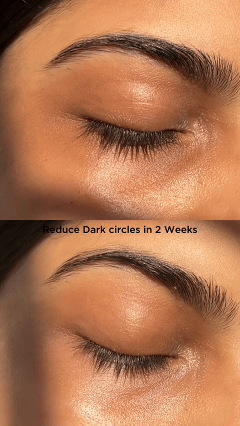 Bye Bye Dark Circles™ – Under Eye Cream with Coffee & Chia Seed Oil (2 Pack × 50 g)