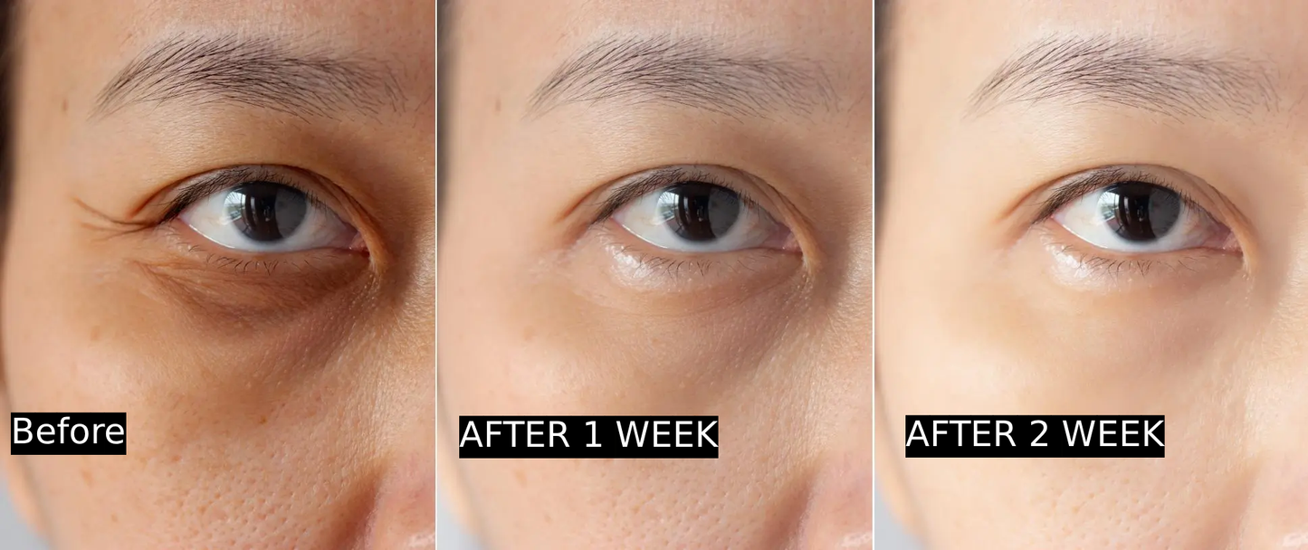 Anti Ageing & Dark Circles Serum 50ML (Pack of 1)